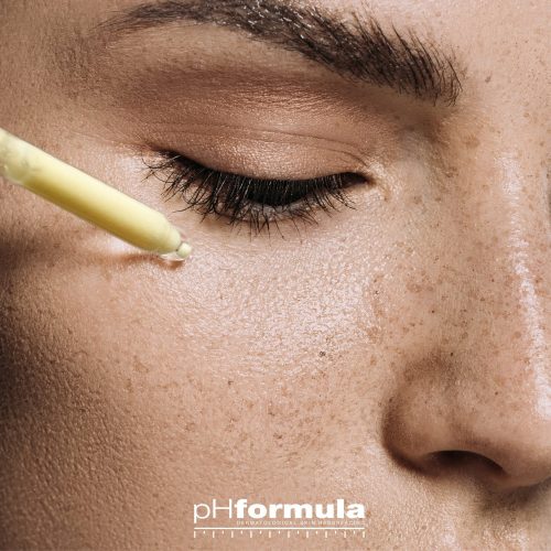 All About Hyperpigmentation